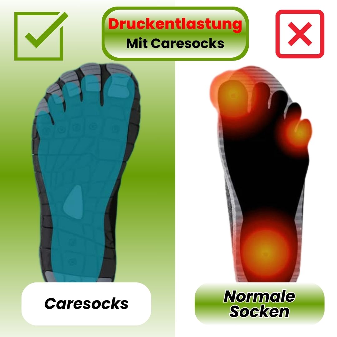 Caresocks orthopädische Kompressionsstrümpfe - verhindert Krampfadern & entlastet müde Füße